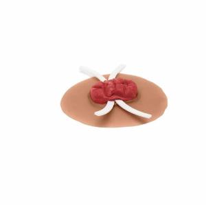 Sim sticky stoma bridge-Med