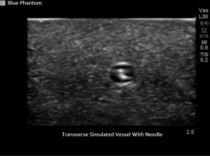Branched 2 vessel µltrasound training block model
