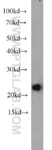 Anti-HPRT1 Rabbit Polyclonal Antibody