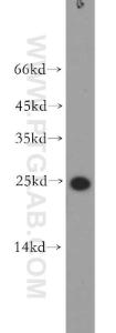 Anti-SFTPC Rabbit Polyclonal Antibody