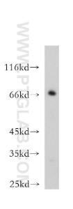 Anti-BVES Rabbit Polyclonal Antibody