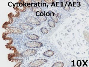 AE1-3 Colon 10X