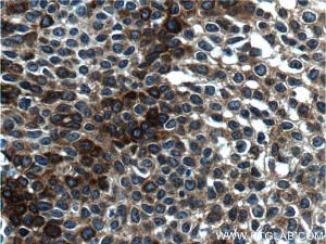 Anti-CK14 Mouse Monoclonal Antibody [clone: 2G1E2]