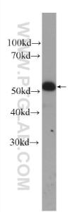 Anti-CK14 Mouse Monoclonal Antibody [clone: 2G1E2]