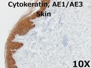 Cytokeratin AE1/AE3 10X