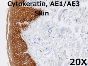 Cytokeratin AE1/AE3 20X