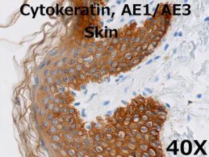 Cytokeratin AE1/AE3 40X