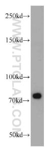 Anti-SYNPO2L Rabbit Polyclonal Antibody