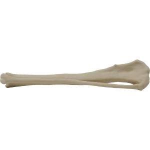 Tibia fibula right