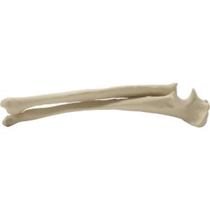 Radius ulna right