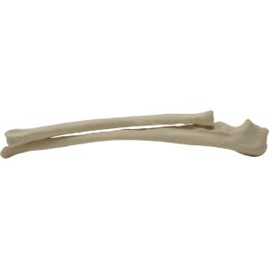 Radius ulna left