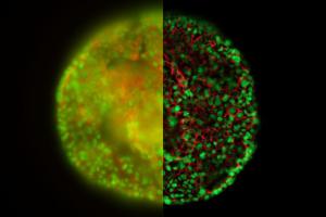 Hela cell spheroid