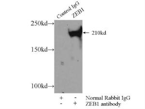 Anti-ZEB1 Rabbit Polyclonal Antibody