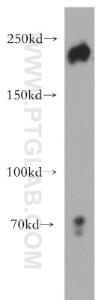 Anti-ZEB1 Rabbit Polyclonal Antibody