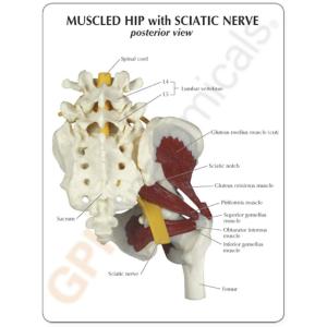 GPI Anatomicals® Muscled Hip with Sciatic Nerve Model