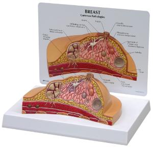 GPI Anatomicals® Basic Breast Cross Section Model