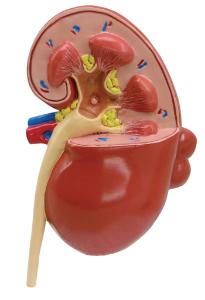 GPI Anatomicals® Kidney Pathology Model