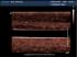 Regional anesthesia µltrasound training block model