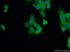 Anti-CK14 Mouse Monoclonal Antibody [clone: 2G1E2]