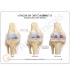 GPI Anatomicals® Stages of Osteoarthritis Knee Model