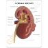 GPI Anatomicals® Kidney Pathology Model