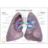 GPI Anatomicals® Lung Set with Pathologies Model